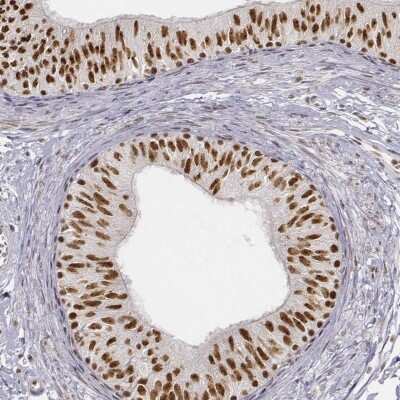 Immunohistochemistry-Paraffin: PHF6 Antibody [NBP1-88646] - Staining of human epididymis shows high expression.