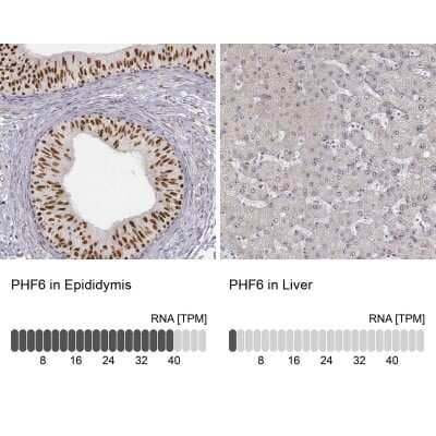 Immunohistochemistry-Paraffin: PHF6 Antibody [NBP1-88646] - Staining in human epididymis and liver tissues using anti-PHF6 antibody. Corresponding PHF6 RNA-seq data are presented for the same tissues.