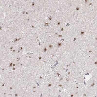 Immunohistochemistry-Paraffin: PHF6 Antibody [NBP1-88646] - Staining of human cerebral cortex shows moderate nuclear and nucleolar positivity in neurons.