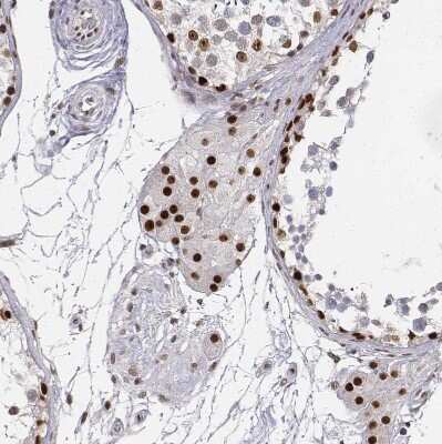 Immunohistochemistry-Paraffin: PHF6 Antibody [NBP1-88646] - Staining of human testis shows strong nuclear positivity in Leydig cells.