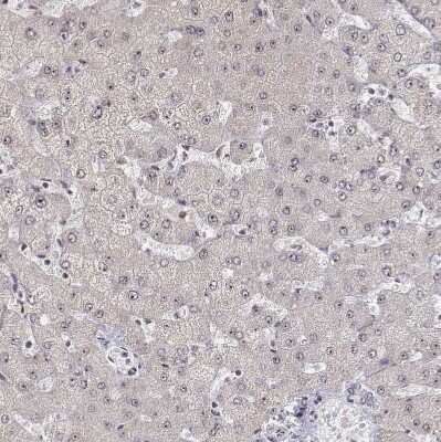 Immunohistochemistry-Paraffin: PHF6 Antibody [NBP1-88646] - Staining of human liver shows no positivity in hepatocytes as expected.