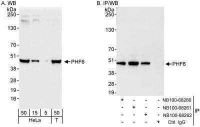 Western Blot: PHF6 Antibody [NB100-68260] - Samples: Whole cell lysate from HeLa (5, 15 and 50 ug for WB; 1 mg for IP, 20% of IP loaded) and 293T (T; 50 ug) cells.  Antibodies: Affinity purified rabbit anti-PHF6 antibody NB100-68260 used for WB at 0.04 ug/ml (A) and 1 ug/ml (B) and used for IP at 3 ug/mg lysate.  PHF6 was also immunoprecipitated by rabbit anti-PHF6 antibodies NB100-68261 and NB100-68262, which recognize downstream epitopes.  Detection: Chemiluminescence with exposure times of 10 seconds (A) and 3 seconds (B).