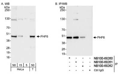 Western Blot: PHF6 Antibody [NB100-68261] - Detection of Human PHF6 on HeLa whole cell lysate using NB100-68261. PHF6 was also immunoprecipitated by rabbit anti-PHF6 antibodies NB100-68260 and NB100-68262.