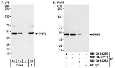 Western Blot: PHF6 Antibody [NB100-68262] - Detection of Human PHF6 on HeLa whole cell lysate.PHF6 was also immunoprecipitated by rabbit anti-PHF6 antibodies NB100-68260 and NB100-68261.