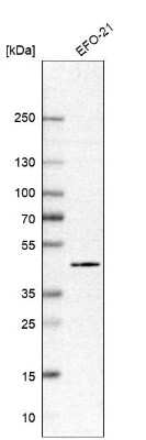 <b>Orthogonal Strategies Validation. </b>Western Blot: PHF6 Antibody [NBP1-88646] - Analysis in human cell line EFO-21.