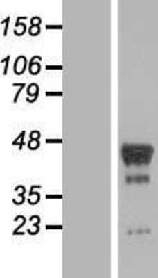 Western Blot: PHF6 Overexpression Lysate (Adult Normal) [NBP2-06017] Left-Empty vector transfected control cell lysate (HEK293 cell lysate); Right -Over-expression Lysate for PHF6.