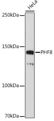 Western Blot: PHF8 Antibody (2H9D4) [NBP3-15910] - Western blot analysis of extracts of HeLa cells, using PHF8 antibody (NBP3-15910) at 1:1000 dilution. Secondary antibody: HRP Goat Anti-Rabbit IgG (H+L) at 1:10000 dilution. Lysates/proteins: 25ug per lane. Blocking buffer: 3% nonfat dry milk in TBST. Detection: ECL Basic Kit. Exposure time: 30s.