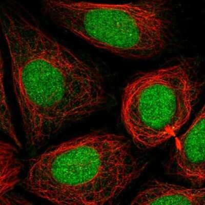 Immunocytochemistry/Immunofluorescence: PHF8 Antibody [NBP2-56147] - Staining of human cell line SiHa shows localization to nucleus.