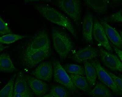 Immunocytochemistry/Immunofluorescence: PHF8 Antibody [NBP2-76957] - ICC staining PHF8 in SiHa cells (green). The nuclear counter stain is DAPI (blue). Cells were fixed in paraformaldehyde, permeabilised with 0.25% Triton X100/PBS.