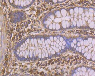 Immunohistochemistry: PHF8 Antibody [NBP2-76957] - Immunohistochemical analysis of paraffin-embedded human colon tissue using anti-PHF8 antibody. Counter stained with hematoxylin.
