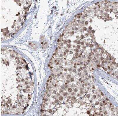 Immunohistochemistry-Paraffin: PHF8 Antibody [NBP1-83079] - Staining of human testis shows moderate nuclear positivity in cells in seminiferous ducts and Leydig cells.