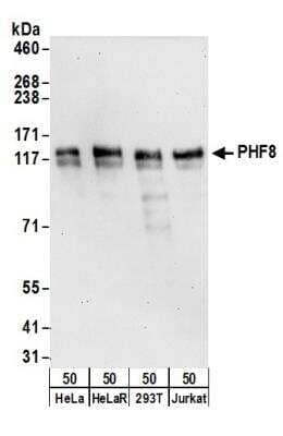 Western Blot PHF8 Antibody