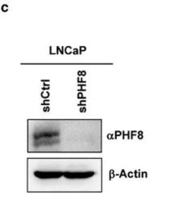 <b>Biological Strategies Validation and Genetic Strategies Validation.</b>Knockdown Validated: PHF8 Antibody [NB100-93314] - Western blot analysis showing knockdown of PHF8 by shRNA against PHF8. LNCaP cells were infected with a lentiviral shPHF8 and western blot analysis was carried out with anti-PHF8 antibody. Image collected and cropped by CiteAb from the  llowing publication (nature.com/articles/oncsis201674), licensed under a CC-BY license.