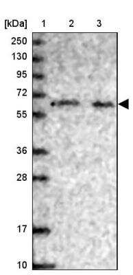 Western Blot PHF8 Antibody