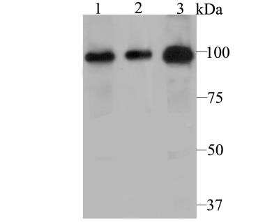 Western Blot: PHF8 Antibody [NBP2-76957] - Western blot analysis of PHF8 on different cell lysate using anti-PHF8 antibody at 1/500 dilution.Positive control:Lane1: PC-3MLane2: A431Lane3: Human kidney tissue