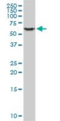 Western Blot: PHGDH Antibody [H00026227-D01P] - Analysis of PHGDH expression in human kidney.