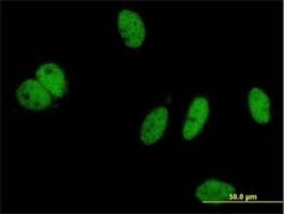 Immunocytochemistry/Immunofluorescence: PHIP Antibody (4D7) [H00055023-M01] - Analysis of monoclonal antibody to PHIP on HeLa cell . Antibody concentration 10 ug/ml.