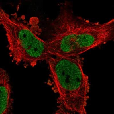 Immunocytochemistry/Immunofluorescence: PHIP Antibody [NBP2-33883] - Staining of human cell line U-251 MG shows localization to nucleoplasm. Antibody staining is shown in green.