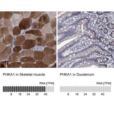 Immunohistochemistry-Paraffin: PHKA1 Antibody [NBP3-17109] - Analysis in human skeletal muscle and duodenum tissues using Anti-PHKA1 antibody. Corresponding PHKA1 RNA-seq data are presented for the same tissues.
