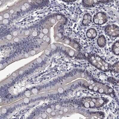 Immunohistochemistry-Paraffin: PHKA1 Antibody [NBP3-17109] - Staining of human duodenum shows low expression as expected.