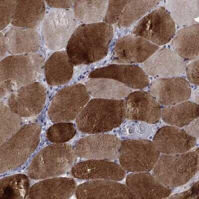 Immunohistochemistry-Paraffin: PHKA1 Antibody [NBP3-17109] - Staining of human skeletal muscle shows high expression.