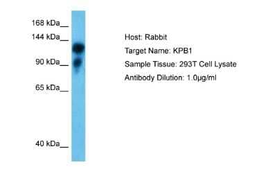 Western Blot: PHKA1 Antibody [NBP2-83392] - Host: Rabbit. Target Name: KPB1. Sample Type: 293T Whole Cell. Antibody Dilution: 1.0ug/ml