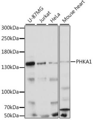 Western Blot: PHKA1 Antibody [NBP2-93393] - Analysis of extracts of various cell lines, using PHKA1 at 1:1000 dilution. Secondary antibody: HRP Goat Anti-Rabbit IgG (H+L) at 1:10000 dilution. Lysates/proteins: 25ug per lane. Blocking buffer: 3% nonfat dry milk in TBST. Detection: ECL Basic Kit . Exposure time: 10s.
