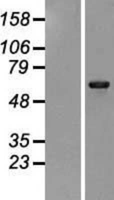 Western Blot: PHKA1 Overexpression Lysate (Adult Normal) [NBP2-09405] Left-Empty vector transfected control cell lysate (HEK293 cell lysate); Right -Over-expression Lysate for PHKA1.