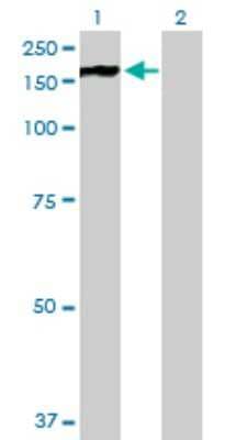 Western Blot: PHKA2 Antibody [H00005256-B01P] - Analysis of PHKA2 expression in transfected 293T cell line by PHKA2 polyclonal antibody.  Lane 1: PHKA2 transfected lysate(135.85 KDa). Lane 2: Non-transfected lysate.