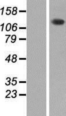 Western Blot: PHKA2 Overexpression Lysate (Adult Normal) [NBP2-09040] Left-Empty vector transfected control cell lysate (HEK293 cell lysate); Right -Over-expression Lysate for PHKA2.