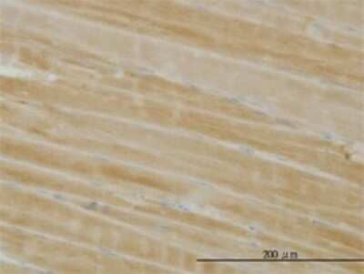 Immunohistochemistry-Paraffin: PHKG1 Antibody (2B4) [H00005260-M02] - Analysis of monoclonal antibody to PHKG1 on formalin-fixed paraffin-embedded human skeletal muscle. Antibody concentration 0.5 ug/ml.