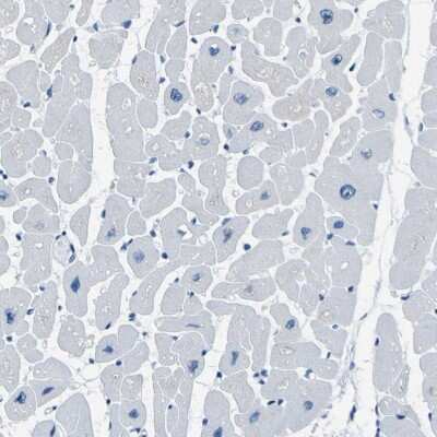 Immunohistochemistry-Paraffin PHKG1 Antibody - BSA Free