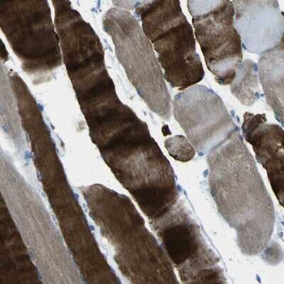 Immunohistochemistry-Paraffin PHKG1 Antibody - BSA Free