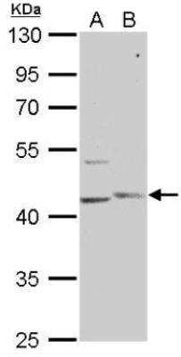 Western Blot: PHKG1 Antibody [NBP1-31548] - A. 30 ug 293T whole cell lysate/extract B. 30 ug HepG2 whole cell lysate/extract10 % SDS-PAGE PHKG1 antibody [N1C3] dilution: 1:1000.
