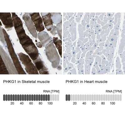 Immunohistochemistry-Paraffin PHKG1 Antibody - BSA Free