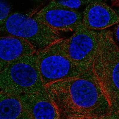 <b>Independent Antibodies Validation. </b>Immunocytochemistry/Immunofluorescence: PHKG2 Antibody [NBP2-55815] - Staining of human cell line MCF7 shows localization to cytosol.