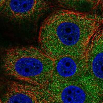 <b>Independent Antibodies Validation. </b>Immunocytochemistry/Immunofluorescence: PHKG2 Antibody [NBP2-56609] - Staining of human cell line MCF7 shows localization to cytosol.