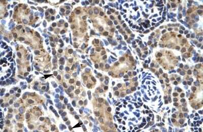 Immunohistochemistry-Paraffin: PHKG2 Antibody [NBP1-54866] - Human kidney Tissue, antibody concentration 4-8ug/ml. Cells with positive label: renal corpuscle cells (indicated with arrows) 400X magnification.