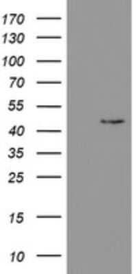 Western Blot: PHKG2 Antibody (OTI1F9) - Azide and BSA Free [NBP2-73373] - Analysis of HEK293T cells were transfected with the pCMV6-ENTRY control (Left lane) or pCMV6-ENTRY PHKG2.