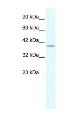 Western Blot: PHKG2 Antibody [NBP1-54866] - HepG2 cell lysate, Antibody Titration: 0.2-1 ug/ml