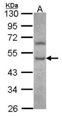 Western Blot: PHKG2 Antibody [NBP2-19802] - Sample (30 ug of whole cell lysate) A: Hela 10% SDS PAGE gel, diluted at 1:1000.