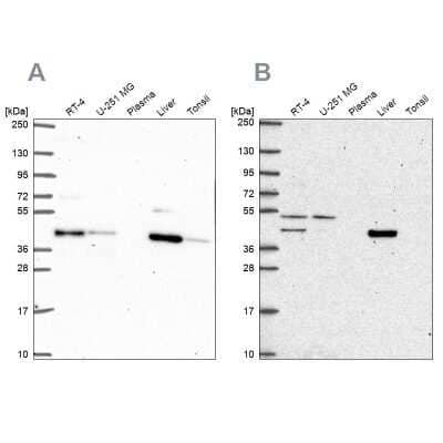 Western Blot: PHKG2 Antibody [NBP2-55815] - Analysis using Anti-PHKG2 antibody NBP2-55815 (A) shows similar pattern to independent antibody NBP2-56609 (B).