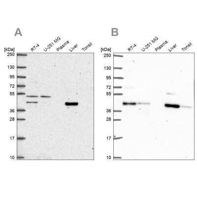 Western Blot: PHKG2 Antibody [NBP2-56609] - Analysis using Anti-PHKG2 antibody NBP2-56609 (A) shows similar pattern to independent antibody NBP2-55815 (B).