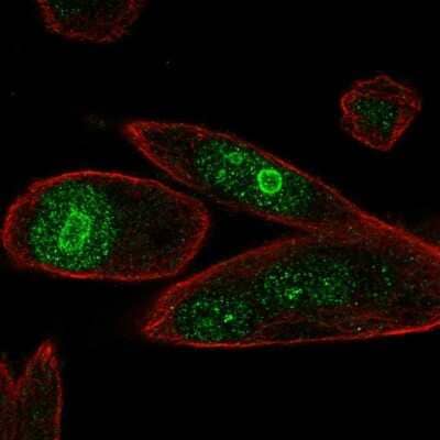 Immunocytochemistry/ Immunofluorescence PHLDA1 Antibody