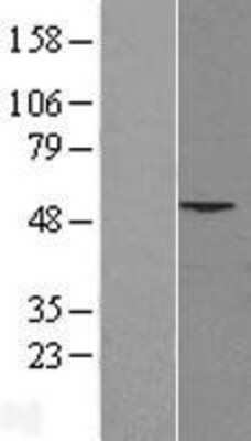 Western Blot PHLDA1 Overexpression Lysate