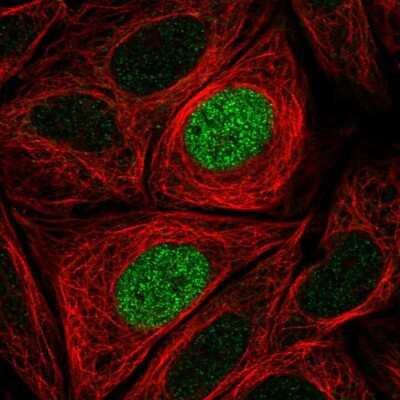 Immunocytochemistry/ Immunofluorescence PHLDB1 Antibody - BSA Free