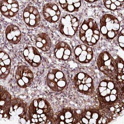 Immunohistochemistry-Paraffin PHLDB1 Antibody - BSA Free