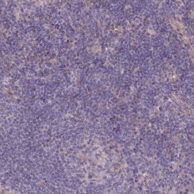 Immunohistochemistry-Paraffin: PHLDB1 Antibody [NBP1-90450] - Staining of human lymph node shows no positivity in lymphoid cells as expected.