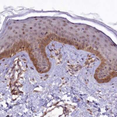 Immunohistochemistry-Paraffin: PHLDB1 Antibody [NBP1-90450] - Staining of human skin shows moderate cytoplasmic positivity in basal epidermal cells.