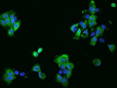 Immunocytochemistry/Immunofluorescence: PHLDB2 Antibody [NBP2-97972] - Immunofluorescence staining of PHLDB2 in A431 cells. Cells were fixed with 4% PFA, permeabilzed with 0.1% Triton X-100 in PBS, blocked with 10% serum, and incubated with rabbit anti-Human PHLDB2 polyclonal antibody (dilution ratio 1:200) at 4C overnight. Then cells were stained with the Alexa Fluor(R)488-conjugated Goat Anti-rabbit IgG secondary antibody (green) and counterstained with DAPI (blue).Positive staining was localized to Cytoplasm and cell membrane.